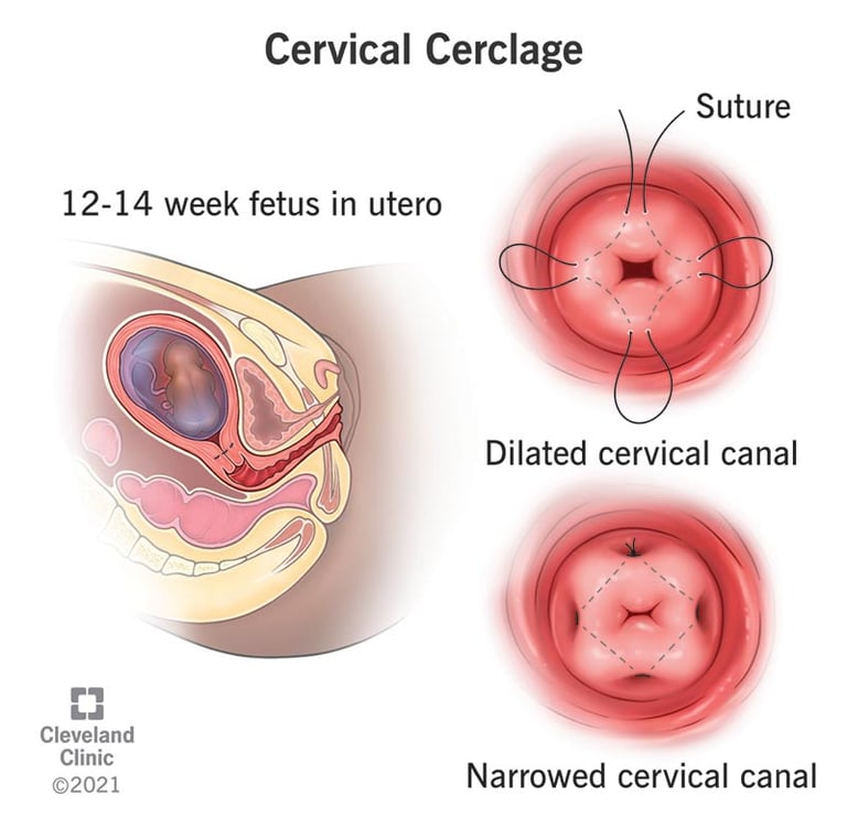 Pic Courtesy : Cleveland Clinic