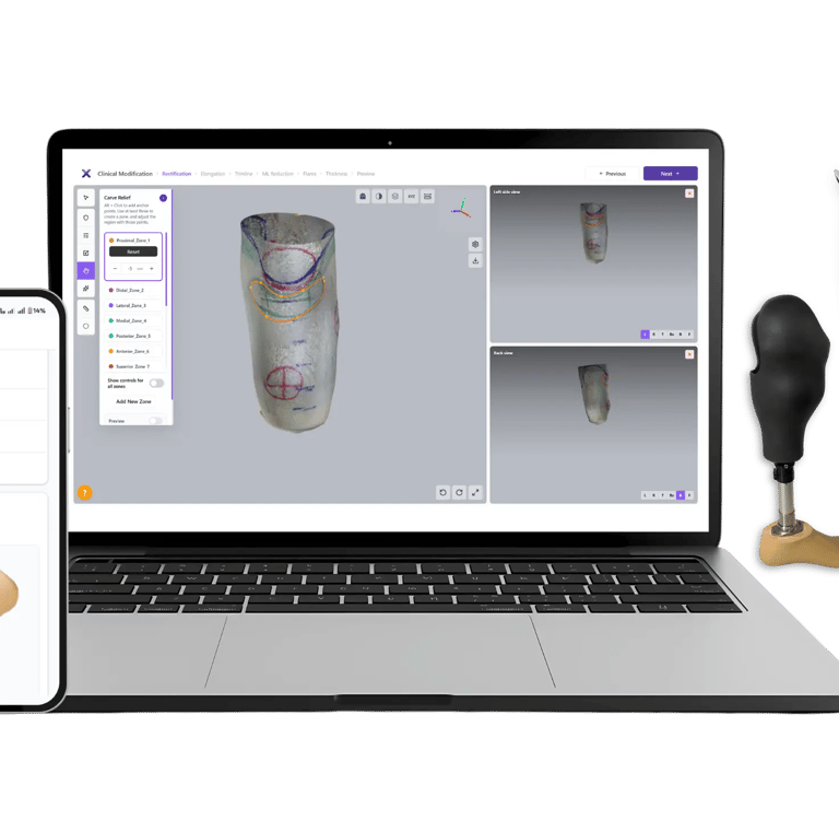 BenX Prosthetic design software