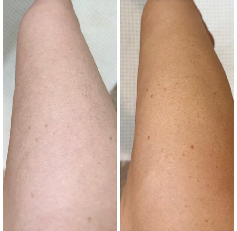 before and after sjolie no. 9