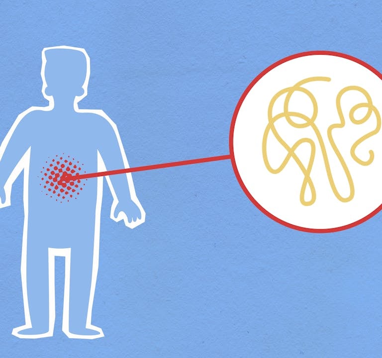 Inflammation Explained: Causes, Symptoms, and Natural Remedies for a Healthier Body