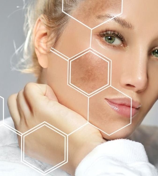 Limpieza facial, peeling antimanchas, rejuvenecimiento de la piel en Barcelona, Lleida y Mataró.