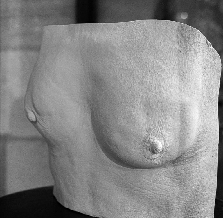 Moulage plâtre - cancer du sein  - Moulage intime Bordeaux
