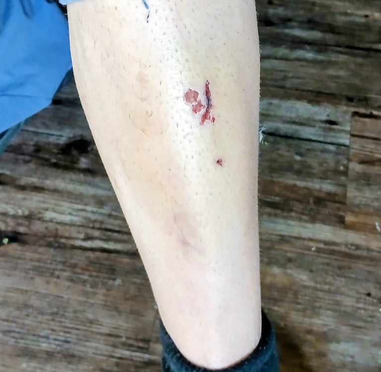 cut on shin fro pedal slip