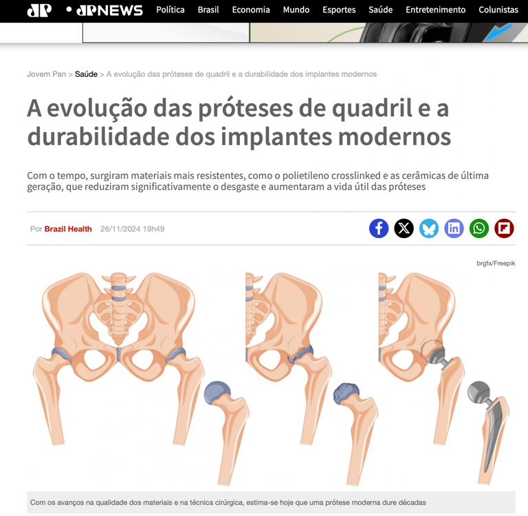 quanto tempo dura uma protese do quadril