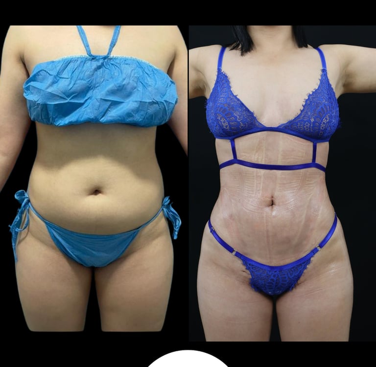 Cirugía Plástica y Rejuvenecimiento Dr. Fabián Orozco