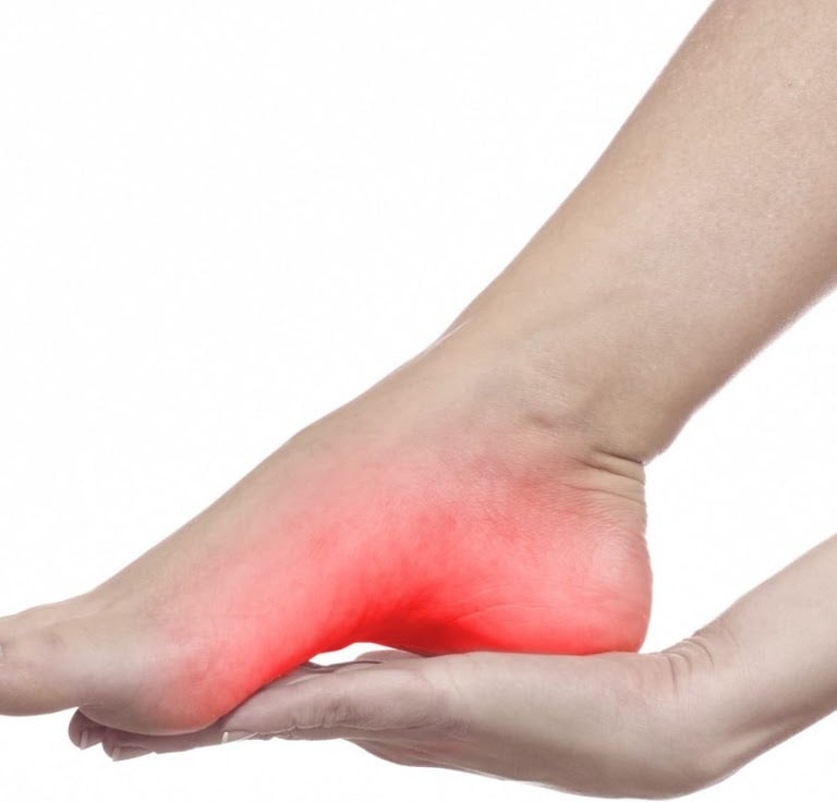 fascite plantar, dor nos pés, sola do pé, dor, sensibilidade