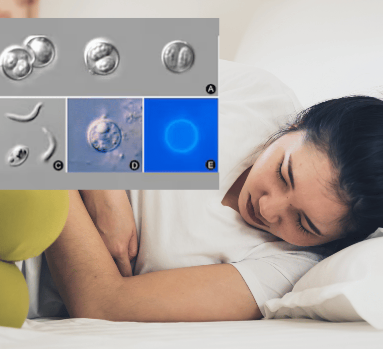 cyclosporiasis in florida
