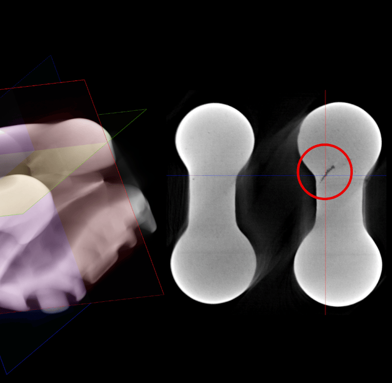 Lỗi thường gặp MIM