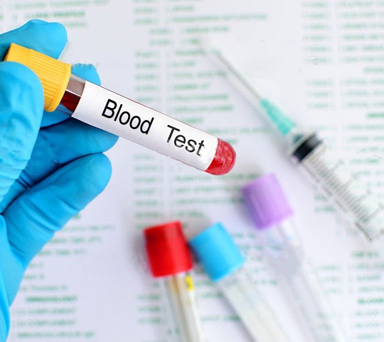 Labs, Blood work, Laboratory testing, Exams, Orders, Thyroid, Hormones