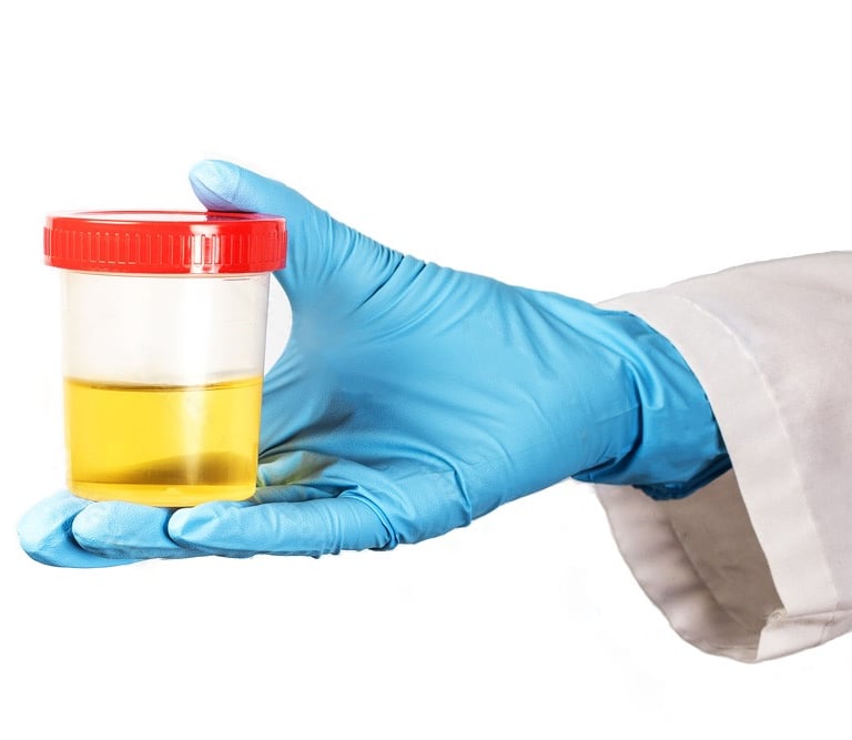 Urinary Tract Infection, Burning, Pee, Urine, Frequency, Antibiotics, Tests, Testing, UTI