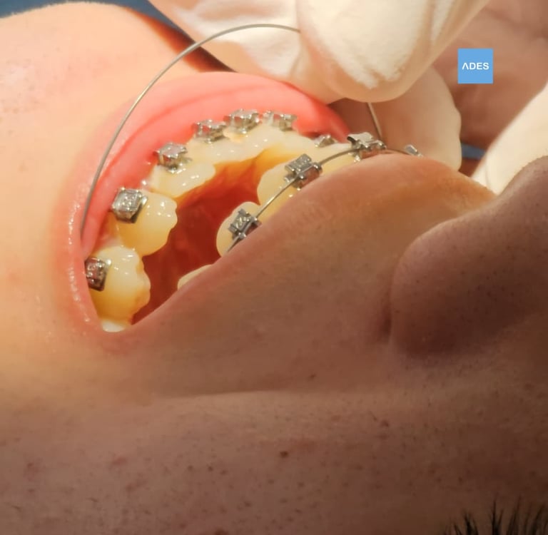 Revisión bucal en Badajoz