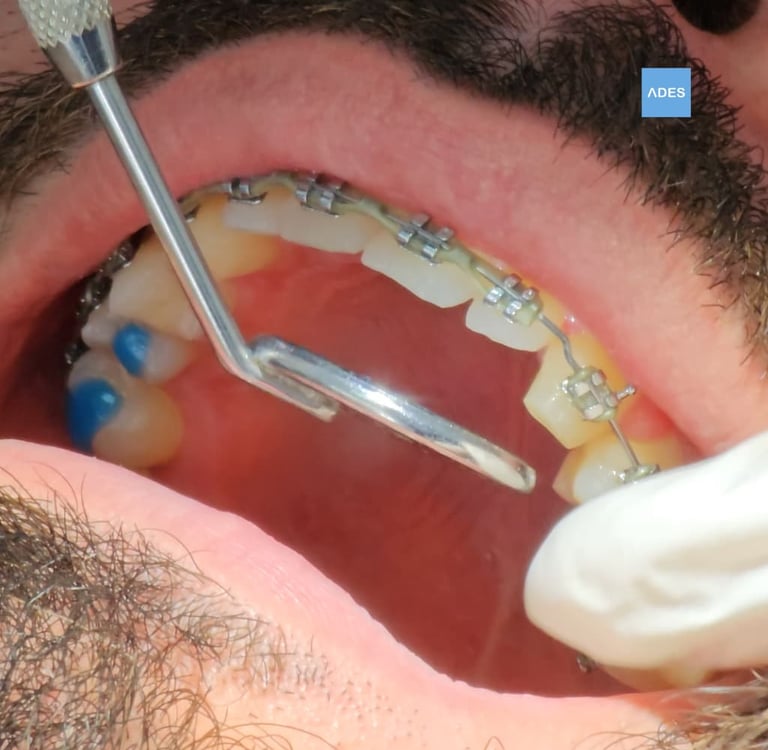 Tratamiento dental para adultos en Badajoz