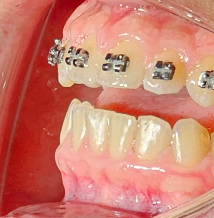 Sala de ortodoncia en Clínica Dental ADES