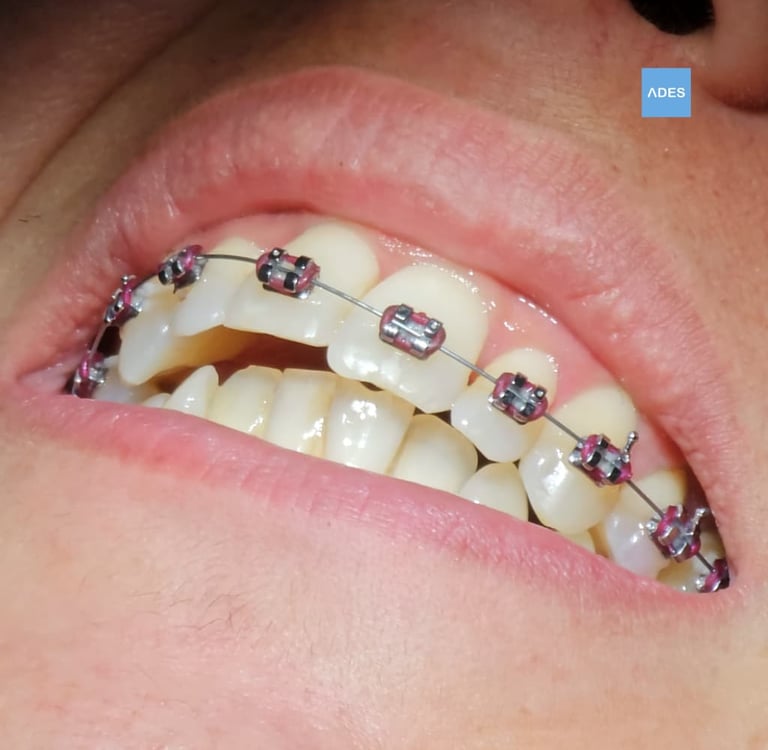 Revisión de ortodoncia en Clínica Dental ADES