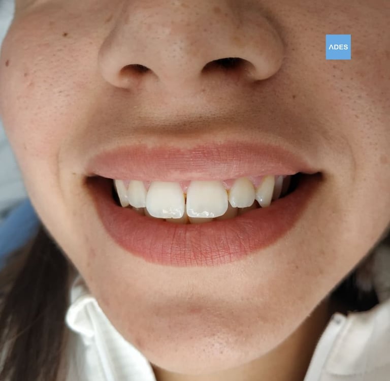 Ortodoncia infantil clinica dental ades