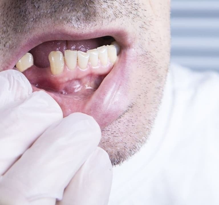 perdida diente badajoz