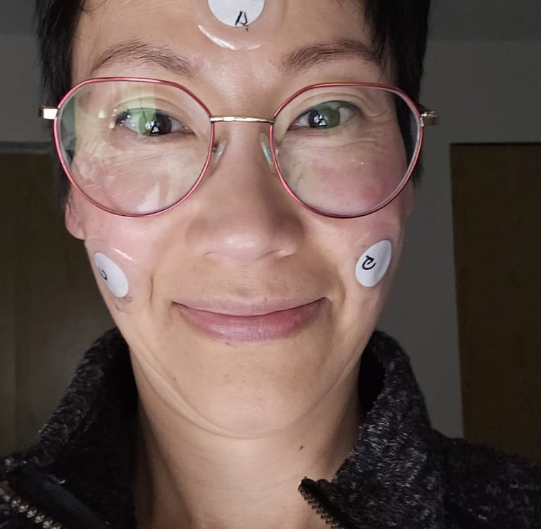 Denise with 3 patches on face