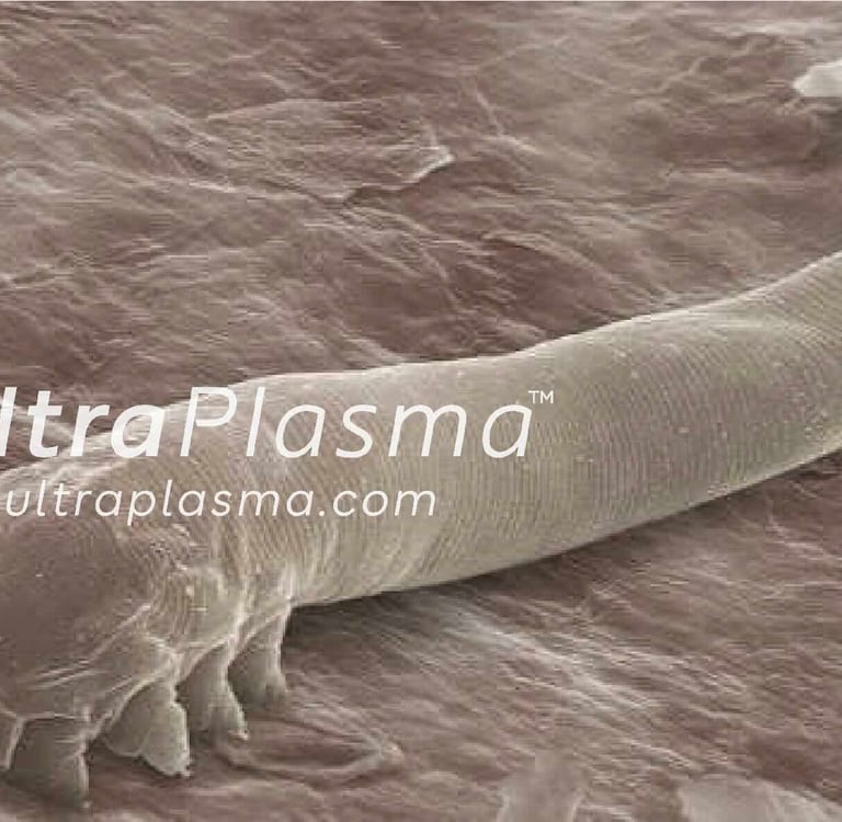 demodex_tedavi_treatment_ultra_plasma_ultra_plazma_ultra-plasma_ultra-plazma