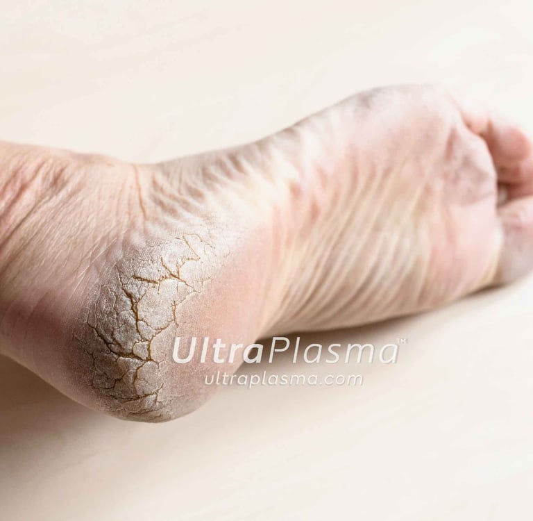 ultra_plasma_ultra_plazma_ultra-plasma_ultra-plazma