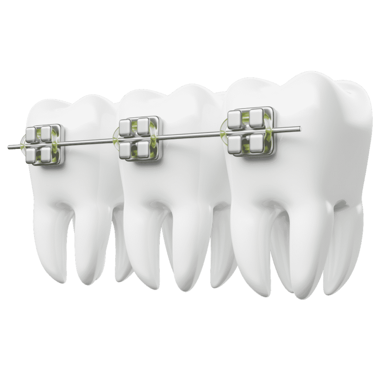 Orthodontist SEO Company Colorado Springs Get Found Before the Consultation Even Starts