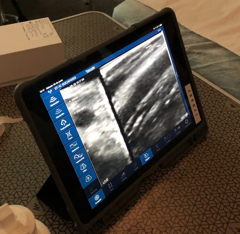 Taller para aprender el manejo de una sonda lineal biplano