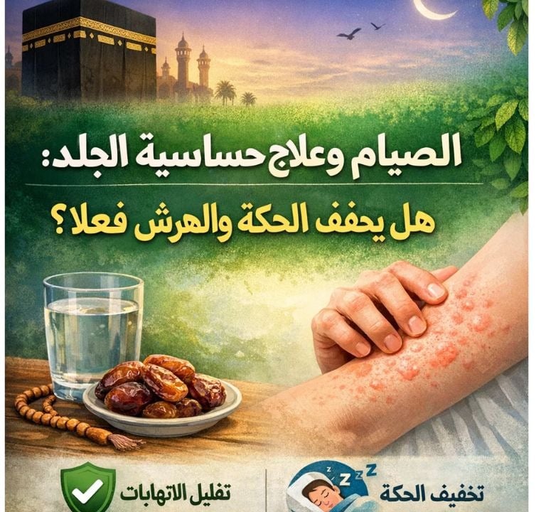 🕋🌿 الصيام وعلاج حساسية الجلد: هل يخفف الحكة والهرش فعلاً؟ 