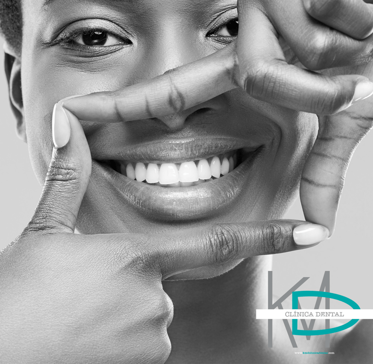 Mujer sonriente mostrando dientes blancos en fotografía en blanco y negro, con logo de KMD Clíni