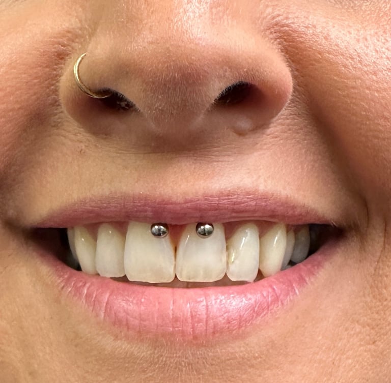 Smiley piercing