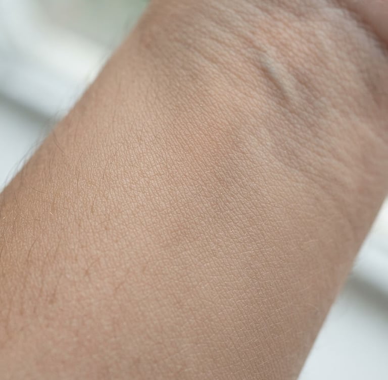 Macro clinical photography of clean healthy skin texture, bright natural daylight, soft shadows, neutral warm tones
