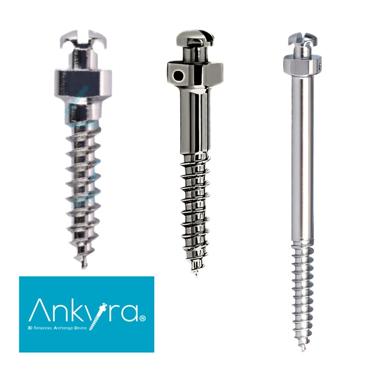 Tornillos interradiculares y extraalveolares Ankyra – biomecánica eficiente