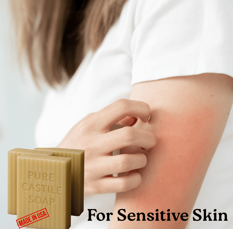A woman with dry skin hold castile soap in her hands