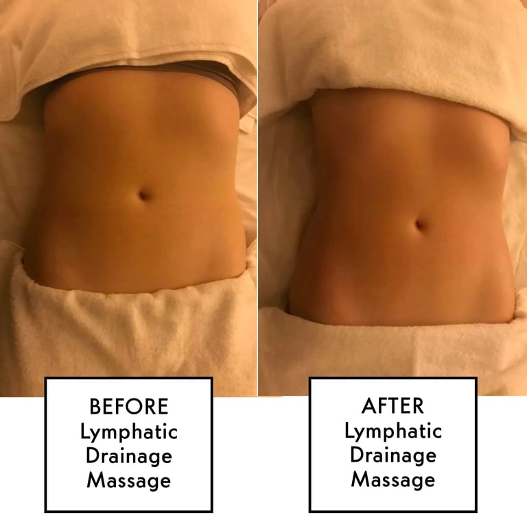 lymphatic massage