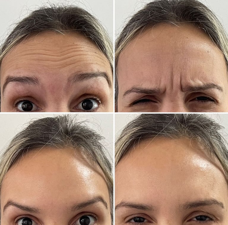 a woman with a lot of wrinkles on her face