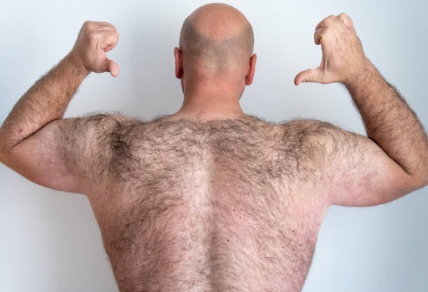 Depilação Masculina costas