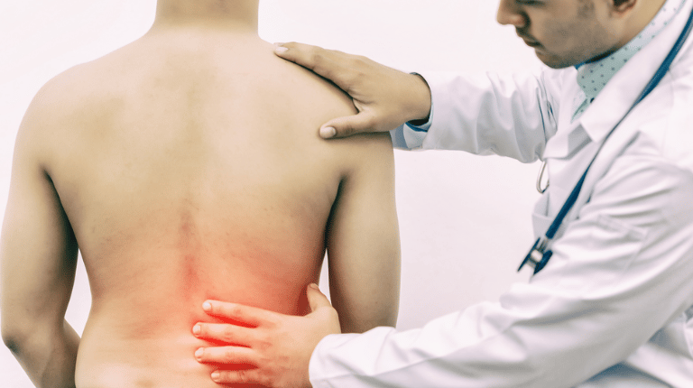 La rectificación cervical es la consecuencia de un trauma o latigazo cervical