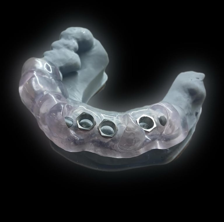 guia quirurgica para implantes dentales