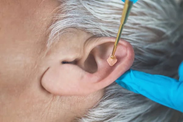 Réflexologie Auriculaire
