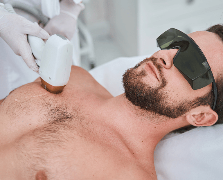man getting laser hair removal on chest