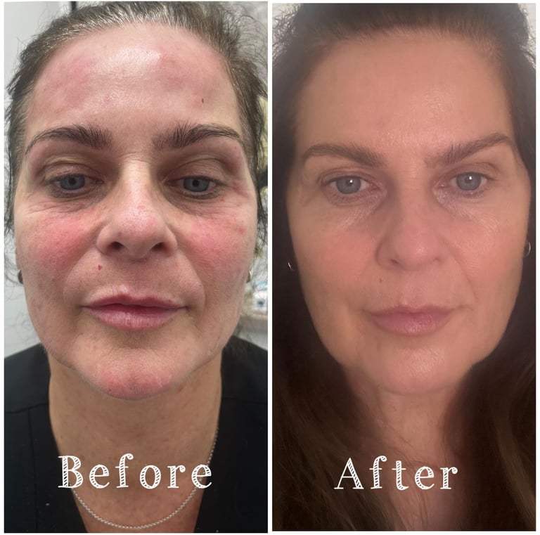 aesthetics liverpool