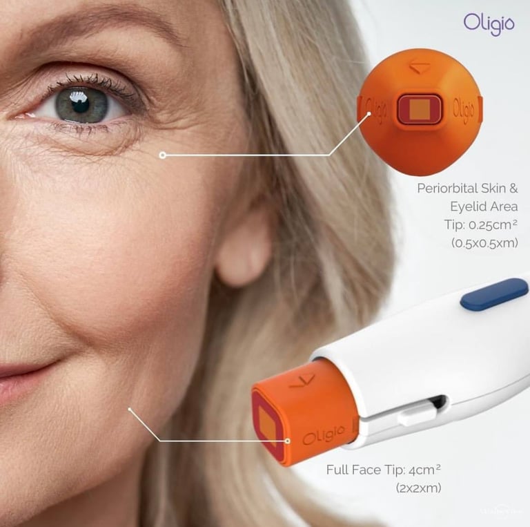 monopolar radiofrequency RF skin tightening