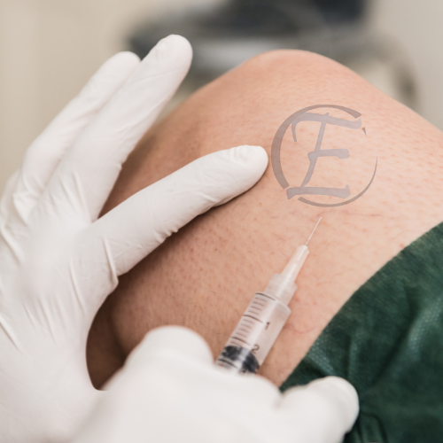 APLICAÇÃO DE ESCLEROTERAPIA