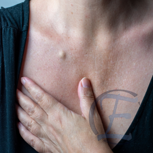 xérese de Cistos Sebáceos, Lipomas e Nevus, sintomas e quando preocupar