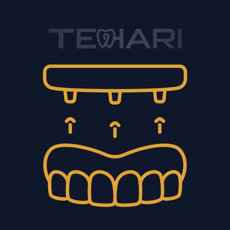 Prótese protocolo na clínica Tehari odontologia em Osasco e Americana SP