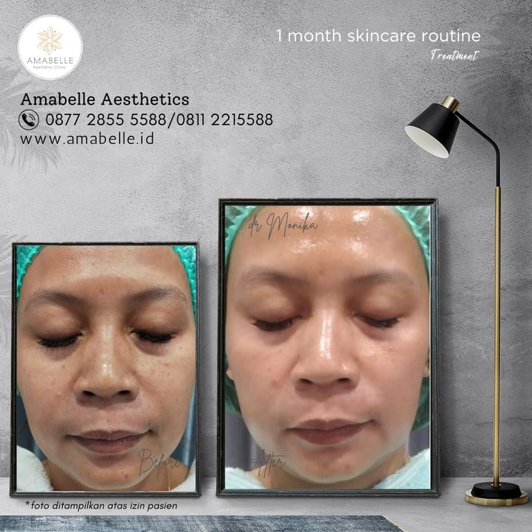 amabelle before after skincare routine