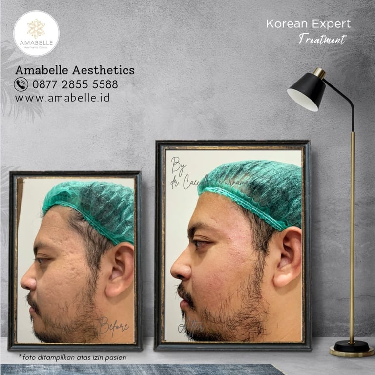amabelle before after korean expert treatment