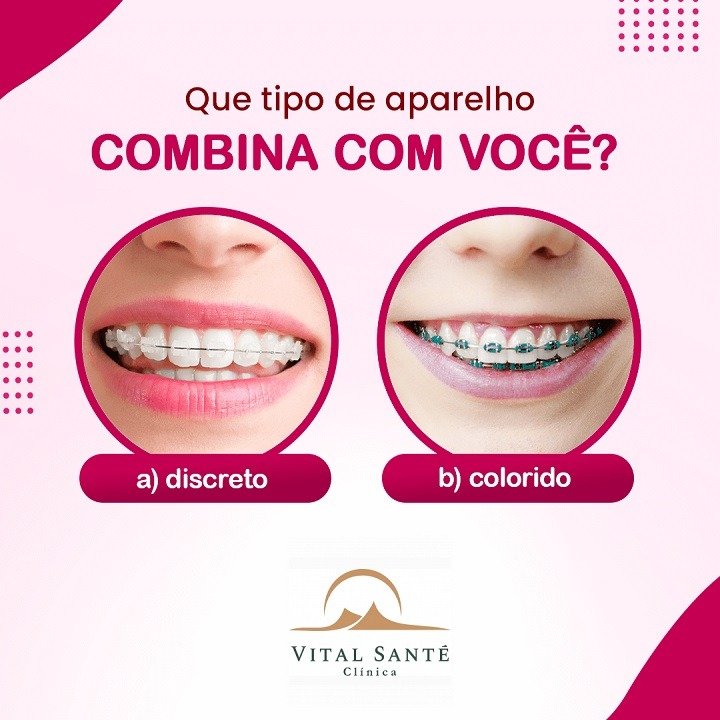 aparelho ortodôntico recreio, aparelho dentário recreio