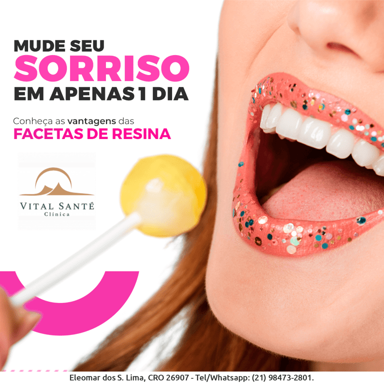 faceta de resina, dentista no recreio dos bandeirantes, dentistas no recreio, dentistas recreio