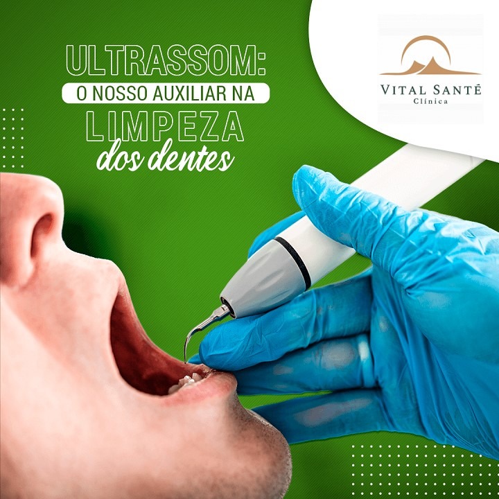 limpeza dentária com ultrassom, dentista recreio