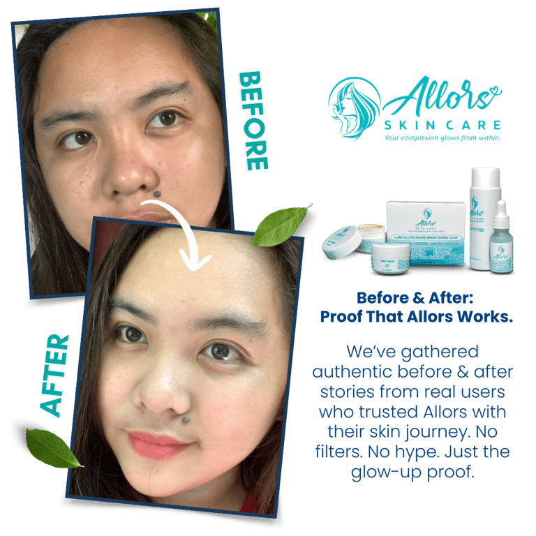 Before-and-after skincare results with Allors, featuring products and a tagline on real user experiences.