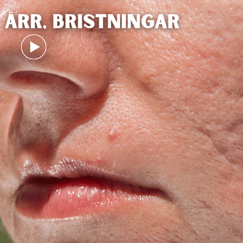 a person with scars in the face